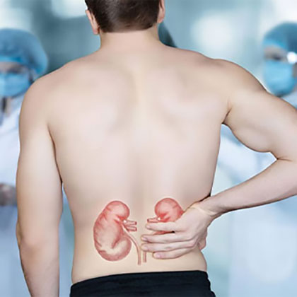 Image of a male person from back holding hand where kidney stays