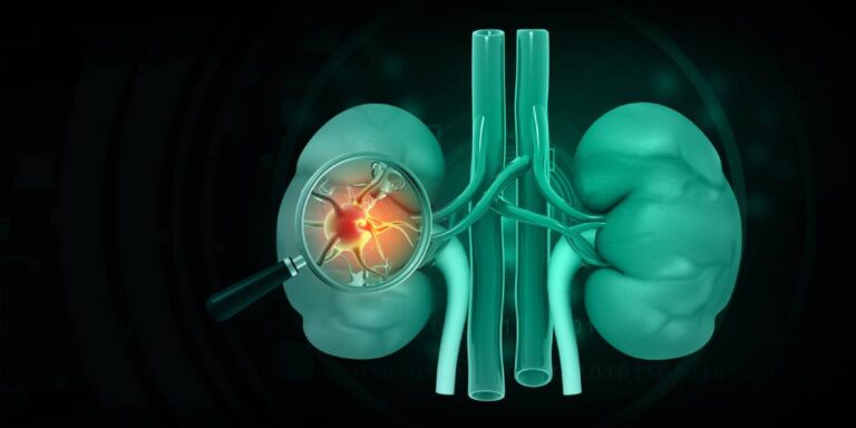 Featured image for How to Prevent Kidney Failure