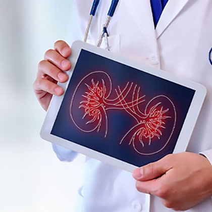 Stock image of a doctor holding coputer pad with a 2d diagram of kidneys